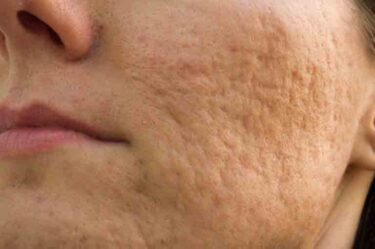 banner-ojeras-mobile-min